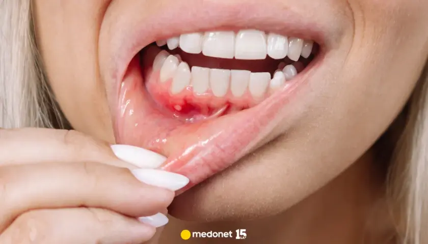 Ból dziąsła: Szybkie domowe sposoby, leki i kiedy iść do dentysty