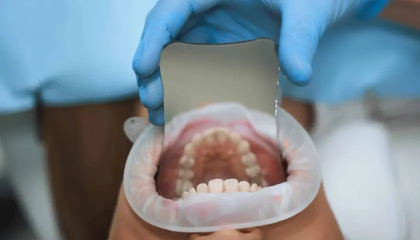 Dentista examina dientes con espejo, detectando una caries leve.