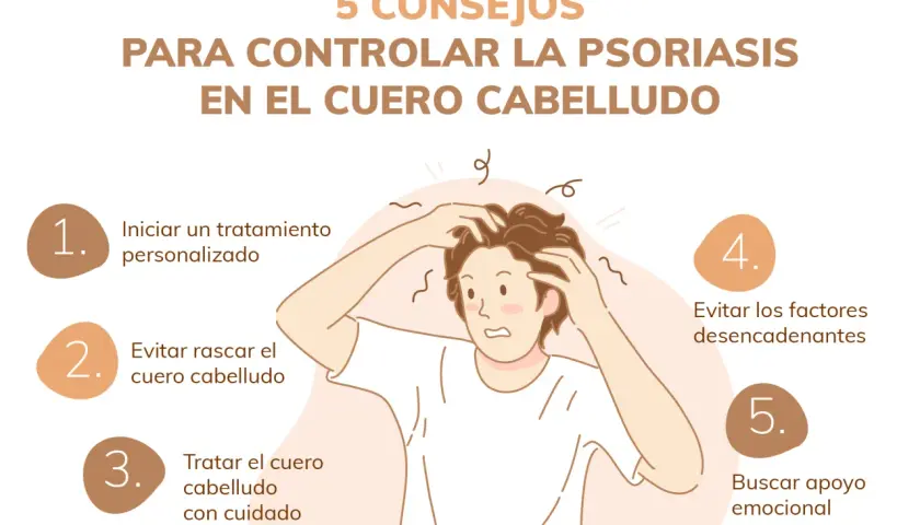 Consejos para controlar la psoriasis en el cuero cabelludo: tratamiento, evitar rascar, cuidado, desencadenantes y apoyo emocional.