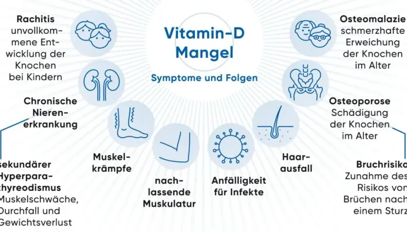 Starker Vitamin D Mangel Symptome: Warnsignale, die Sie beachten sollten