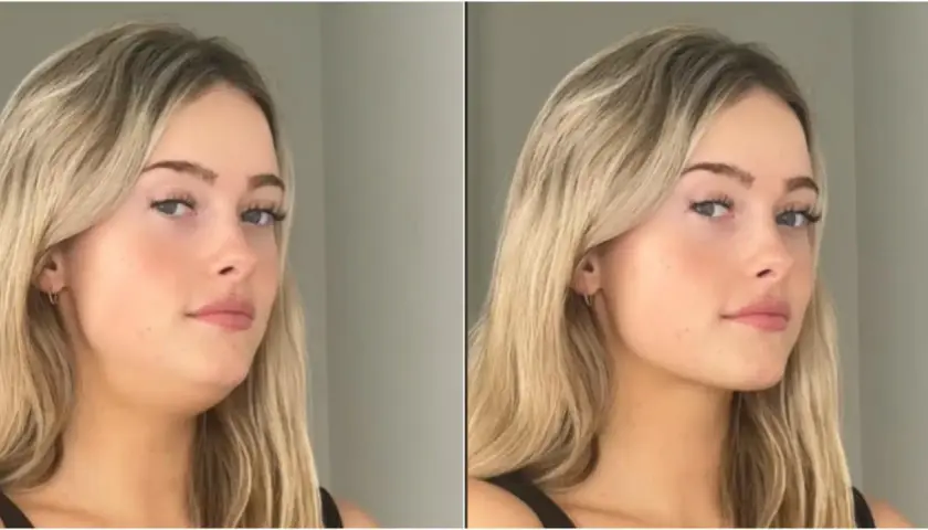 Comparación de antes y después de una mujer. A la izquierda, se ve un doble mentón. A la derecha, tras aplicar la técnica de **que es mewing**, su mandíbula luce más definida.