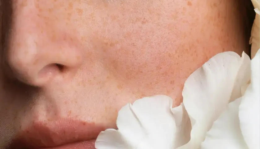 Piel con pecas y un pétalo blanco. Las ceramidas para que sirve: restauran la barrera cutánea, hidratan y protegen.