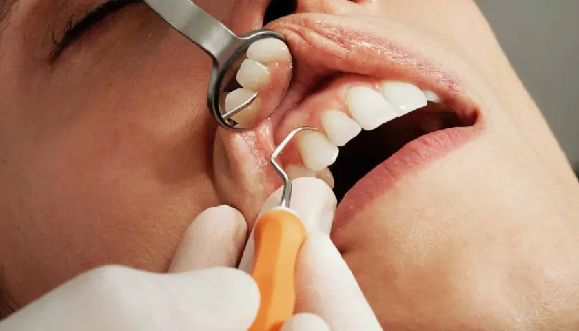 Dentysta bada zęby pacjenta. Zastanawiasz się, ile trwa wyrywanie zęba 6?