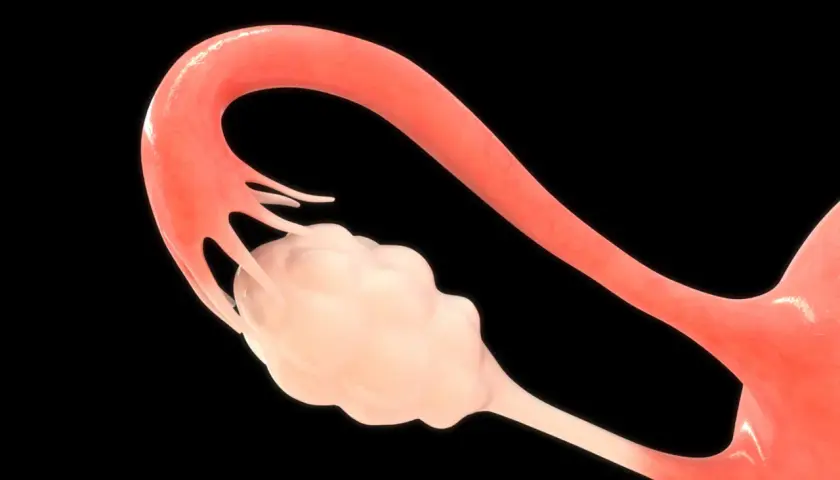 Anatomia kobieca: jajniki i jajowód. Jasnoróżowy jajnik otoczony strzępkami jajowodu.