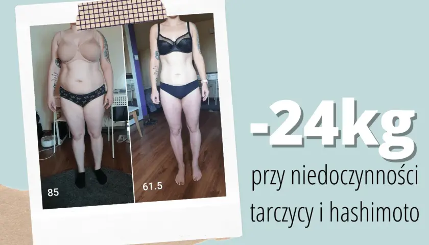 Przed i po: utrata 24 kg przy niedoczynności tarczycy i hashimoto. Zmiana sylwetki dzięki odpowiedniej diecie.