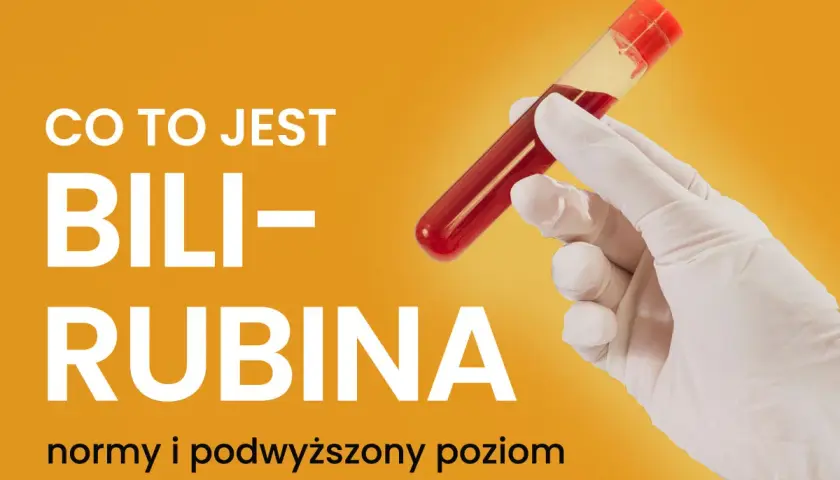 Co to jest bilirubina? Normy i podwyższony poziom. Ręka w rękawiczce trzyma probówkę z krwią.