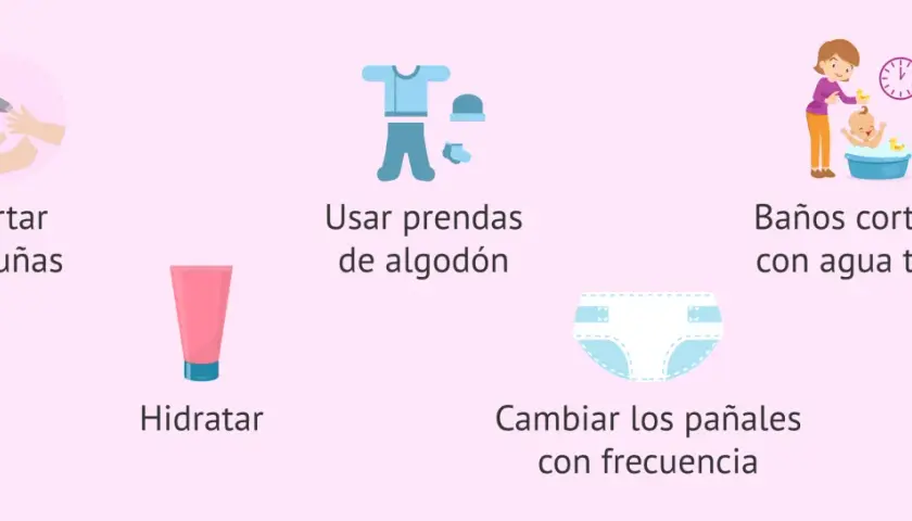 Consejos para el cuidado de la piel atópica en niños: cortar uñas, hidratar, usar algodón, baños tibios y cambiar pañales.