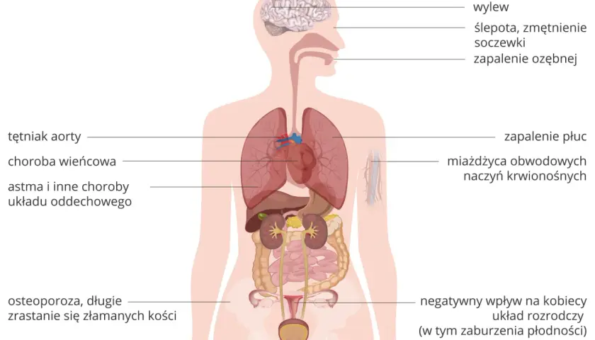 Ilustracja przedstawia ludzki organizm z zaznaczonymi narządami i schorzeniami, w tym astmą i innymi chorobami układu oddechowego.