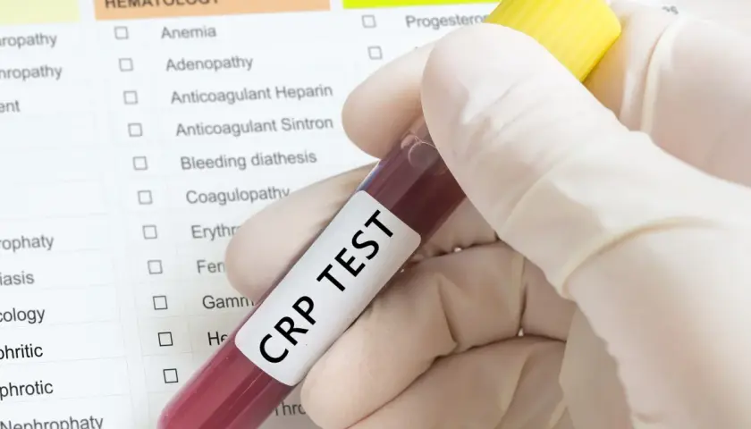 Ręka w rękawiczce trzyma probówkę z krwią do badania CRP TEST. Na tle widoczna lista badań, m.in. białko c reaktywne.