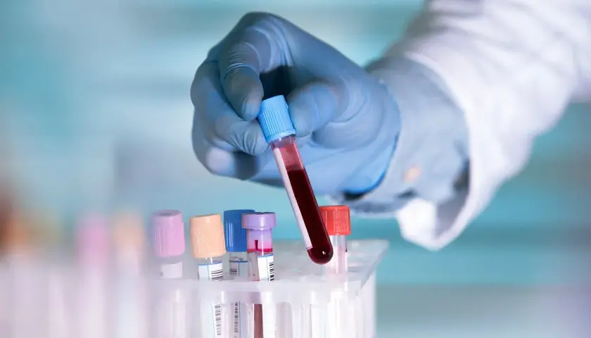 Ręka w niebieskiej rękawiczce trzyma probówkę z krwią. Badanie lipoproteiny a co to jest, kluczowe dla zdrowia serca.
