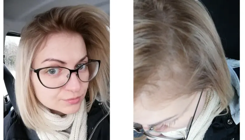 Farba do włosów nie chwyta? Oto dlaczego i jak to naprawić!