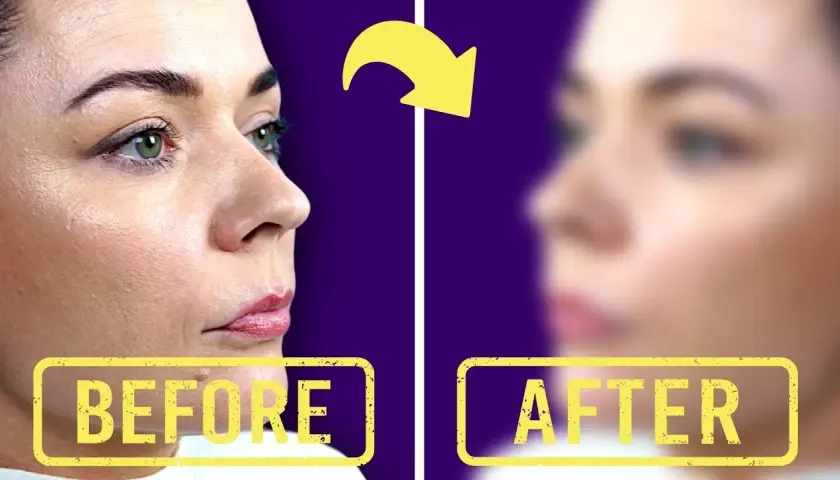 Kiedy można się malować po powiększaniu ust bez ryzyka infekcji?