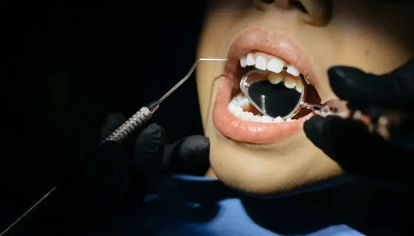 Boca abierta con espejo dental y explorador. ¿Se me rompen las muelas? Significa que es hora de visitar al dentista.