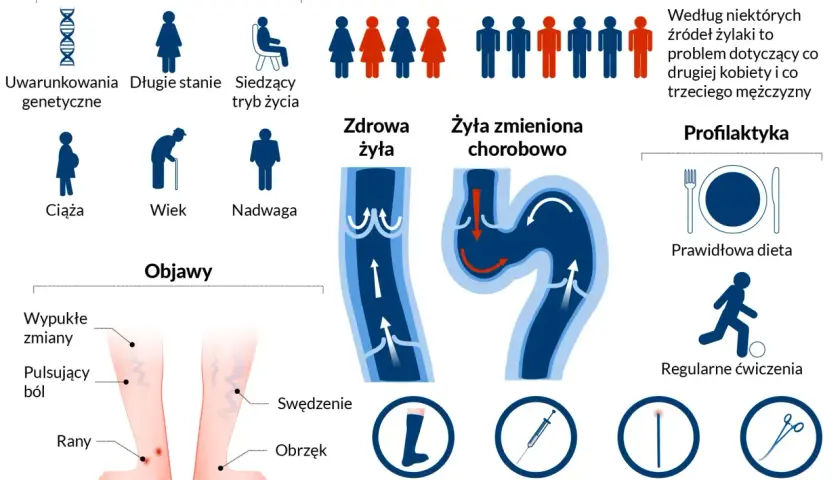 Objawy niewydolności żylnej: wypukłe zmiany, pulsujący ból, rany, swędzenie, obrzęk. Czynniki ryzyka i profilaktyka żylaków.