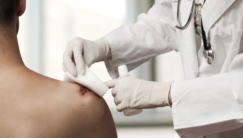 Lekarz zakłada opatrunek Desaulta na ranę na ramieniu pacjenta.
