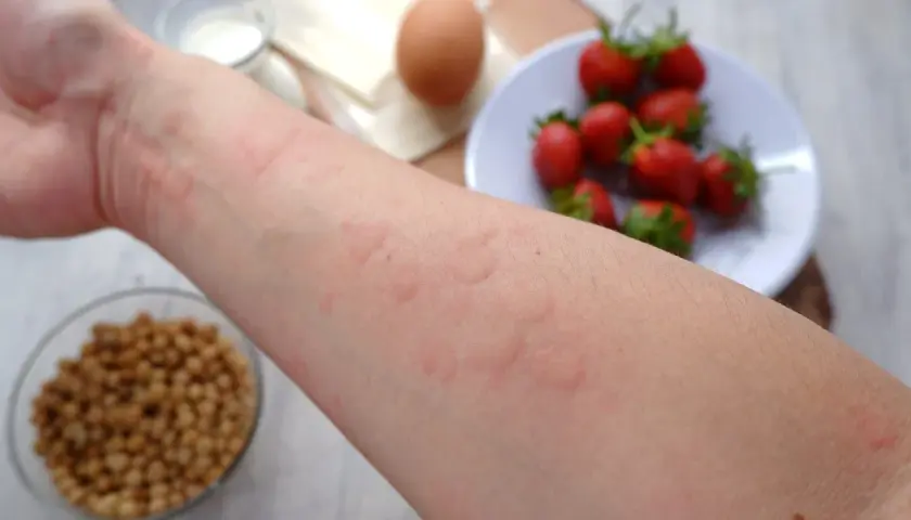 Alergia u dziecka: Szybka ulga w domu i kiedy do lekarza?