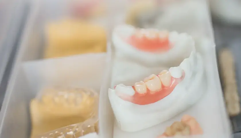 Protesi mobile inferiore in fase di lavorazione. Si osservano i denti artificiali e la base rosa, pronti per risolvere i problemi di masticazione.