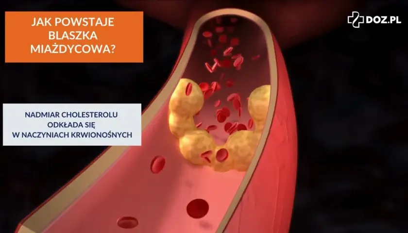 Cholesterol całkowity 220: Granica, sygnał, czy zagrożenie?