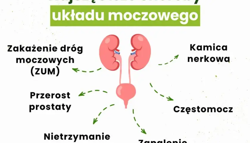 Przyczyny zapalenia pęcherza moczowego: co musisz wiedzieć, aby uniknąć problemów