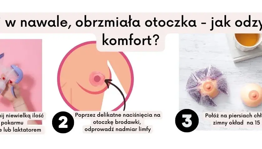 Nawał pokarmu po porodzie - skuteczne sposoby na ulgę i wygodne karmienie