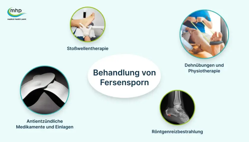 Behandlung von Fersensporn: Stoßwellentherapie, Dehnübungen, Medikamente, Einlagen und Röntgenreizbestrahlung.