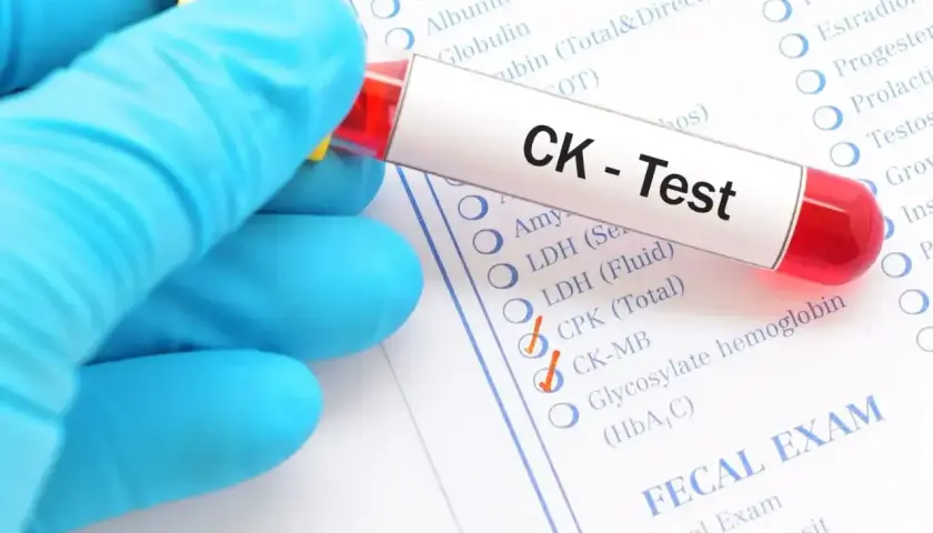 Ręka w niebieskiej rękawiczce trzyma probówkę z napisem "CK - Test". Obok zaznaczono "CPK (Total)", co może wskazywać na podwyższona kinaza kreatynowa objawy.