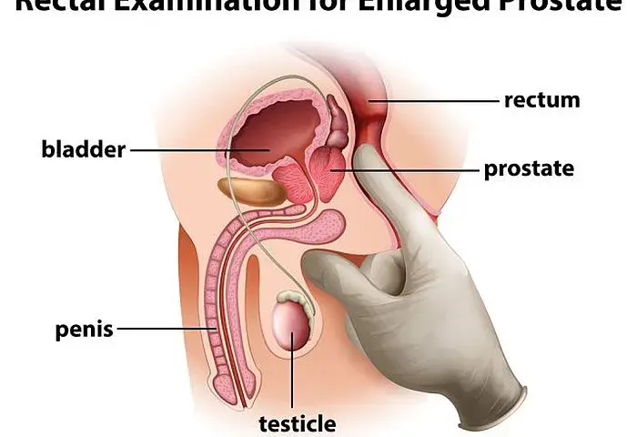 Masaż prostaty: Instrukcja dla zdrowia i przyjemności. Jak zacząć?