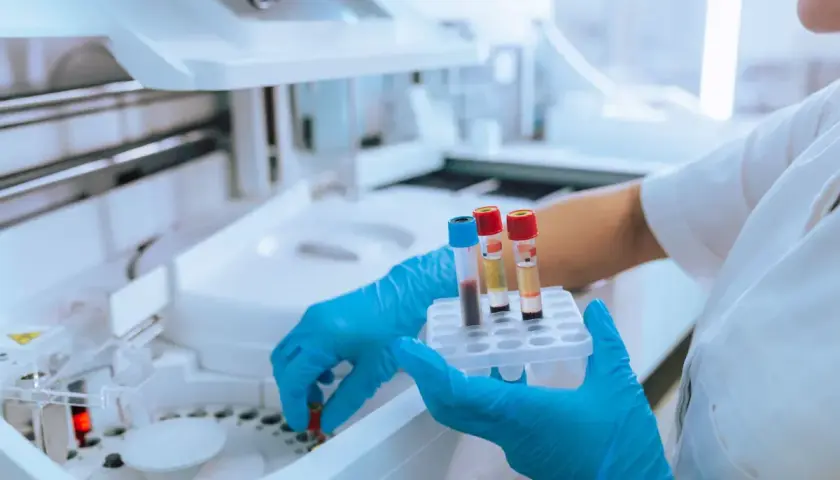 Ręce w niebieskich rękawiczkach trzymają probówki z krwią przy aparaturze laboratoryjnej.