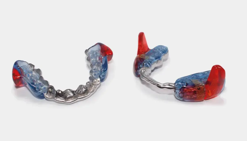 Dos aparatos mandibulares transparentes con detalles en rojo y azul, uno con una banda metálica.