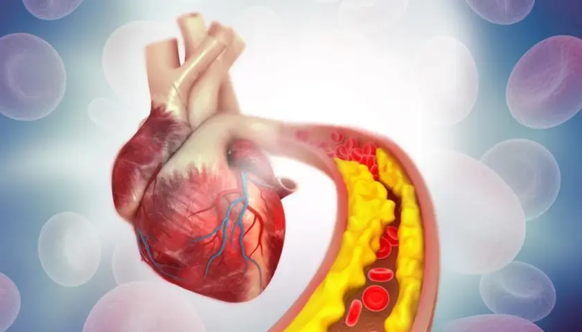 Twój cholesterol: Jak zbadać, zrozumieć wyniki i chronić serce?