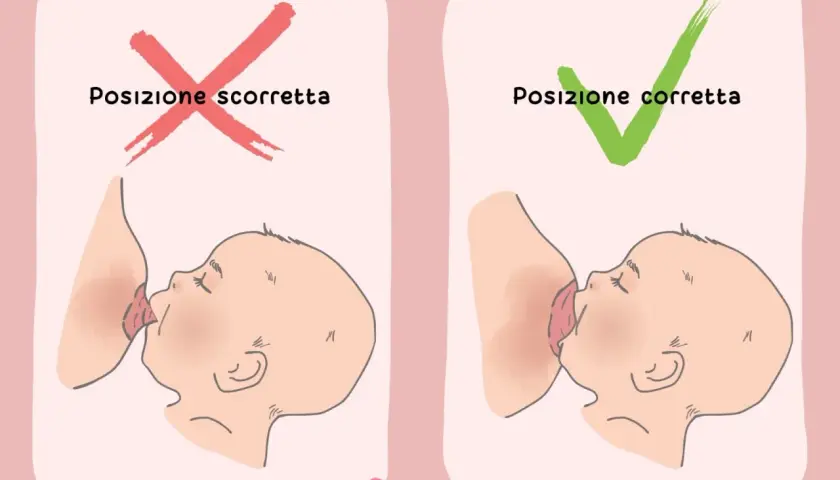 Posizione scorretta vs corretta per allattare, per evitare ragadi al seno.