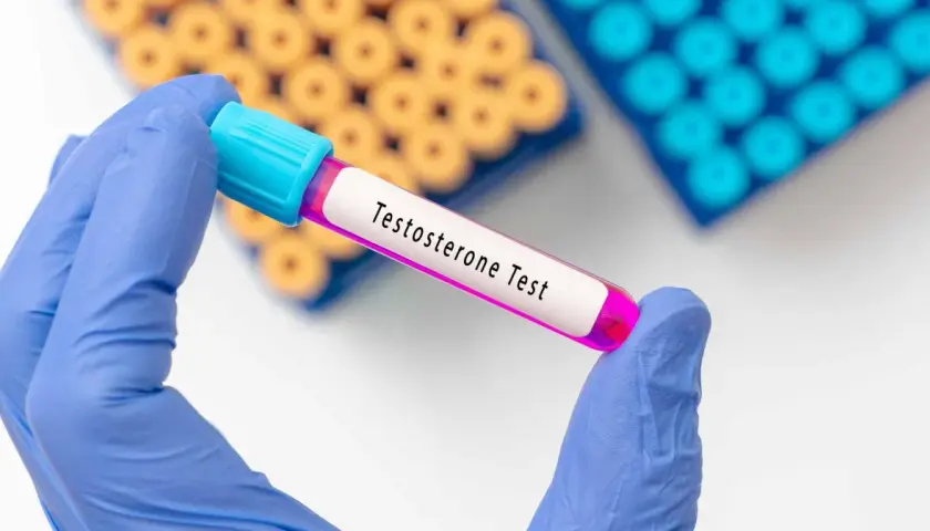 Testosteron bez recepty w jakim kraju? Sprawdź, gdzie jest dostępny