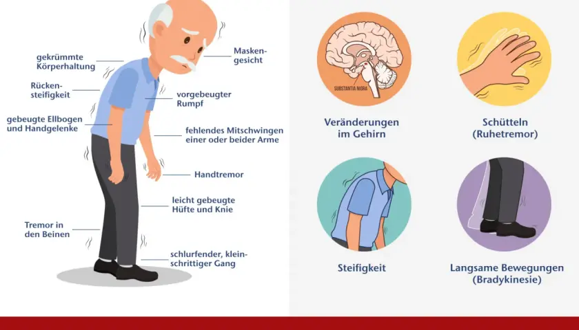 Die entscheidenden Schritte zur Parkinson Diagnostik verstehen