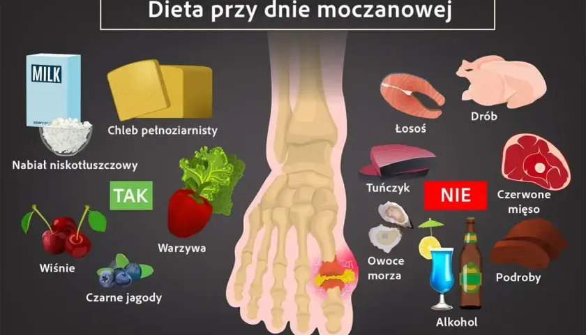 Dieta przy dnie moczanowej: TAK - nabiał, chleb, warzywa, owoce. NIE - drób, ryby, czerwone mięso, podroby, alkohol.