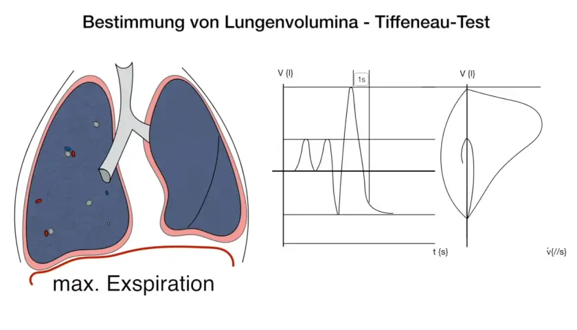 Lungenvolumenbestimmung mittels Tiffeneau-Index: Lunge, Fluss-Volumen-Kurve und Zeit-Volumen-Diagramm.