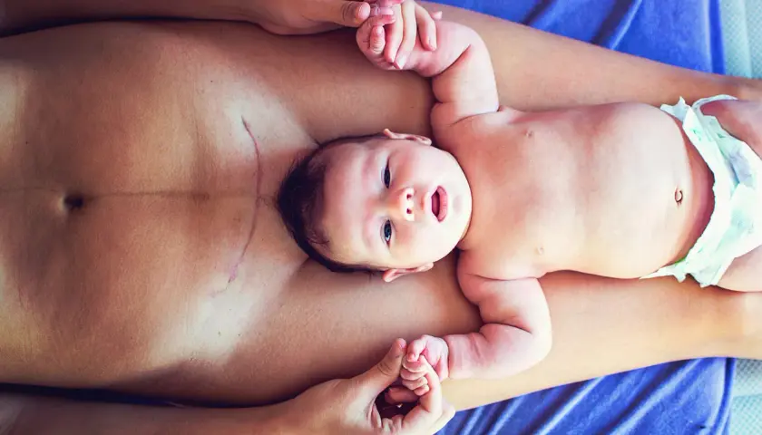 Neugeborenes Baby auf dem Bauch der Mutter, die eine Kaiserschnittnarbe hat. Sanfte Berührung und Heilung durch Osteopathie nach Kaiserschnitt.