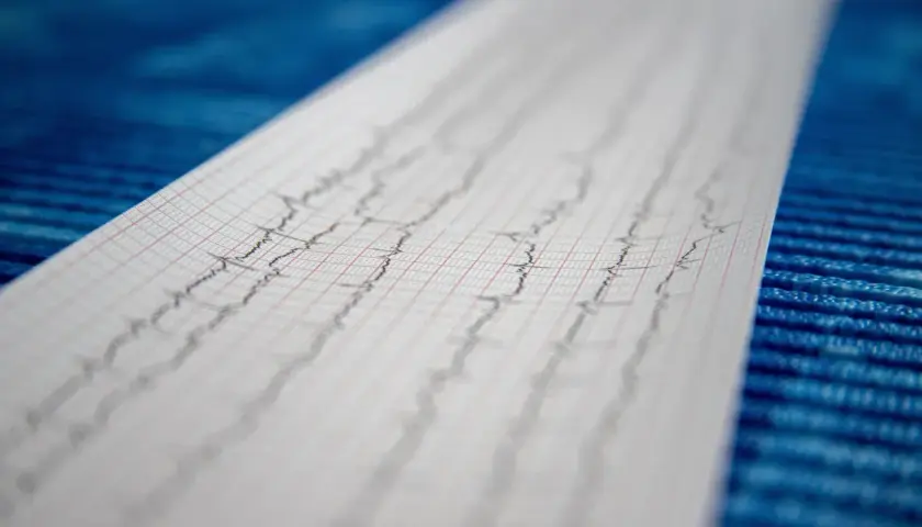 Wynik badania EKG, zapis fal na papierze milimetrowym.