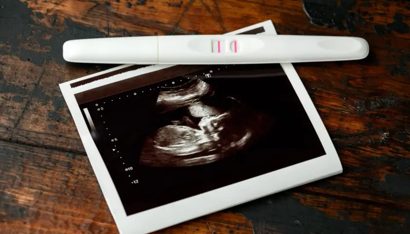 Test ciążowy z dwoma kreskami i zdjęcie USG. To już 7 tydzień ciąży, małe serduszko bije!