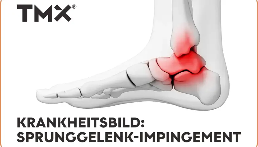 3D-Darstellung eines Fußes mit rot markiertem Sprunggelenk.