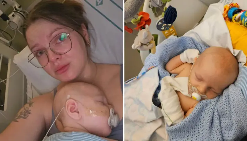 En mamma håller sitt sovande barn. Barnet har en sond och en napp. Det är en tuff tid, men bebis spyr mycket och behöver extra omvårdnad.
