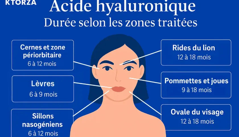 Infographie sur la durée des effets de l'acide hyaluronique selon les zones traitées : cernes, lèvres, rides, pommettes, ovale du visage. Un bienfait pour la peau.