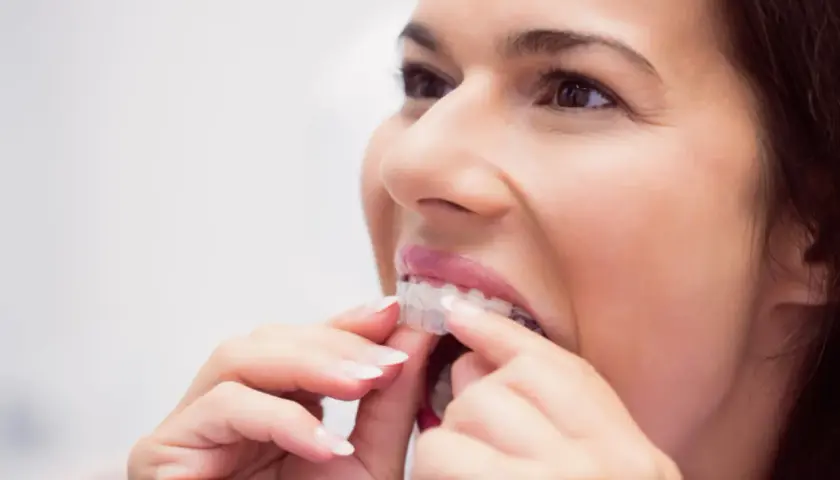 Mujer ajustando su ortodoncia invisible. Un tratamiento que también ayuda a prevenir la periodontitis.