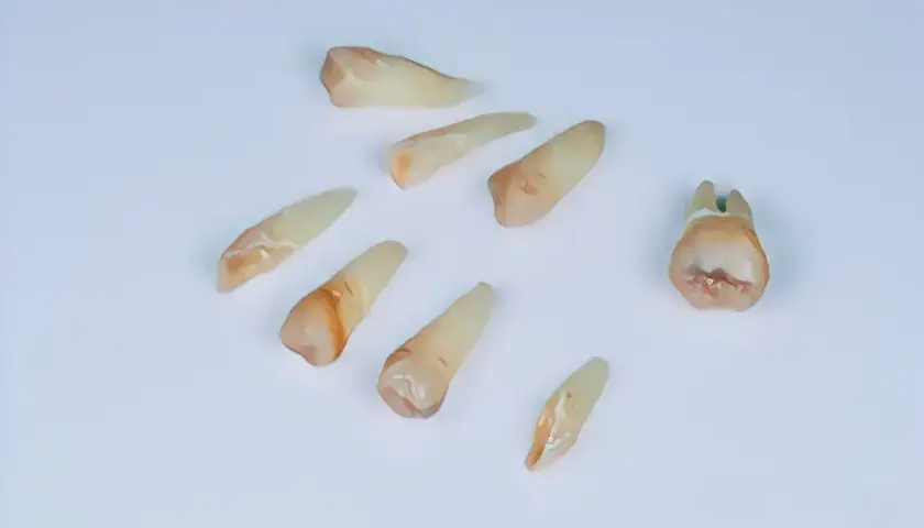 Ból po wyrwaniu ósemki: Jak długo? Kiedy do dentysty?