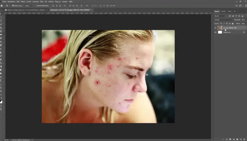 Młoda kobieta z trądzikiem na twarzy, edytowana w Photoshopie. Widoczny panel warstw i narzędzie pędzel photoshop.
