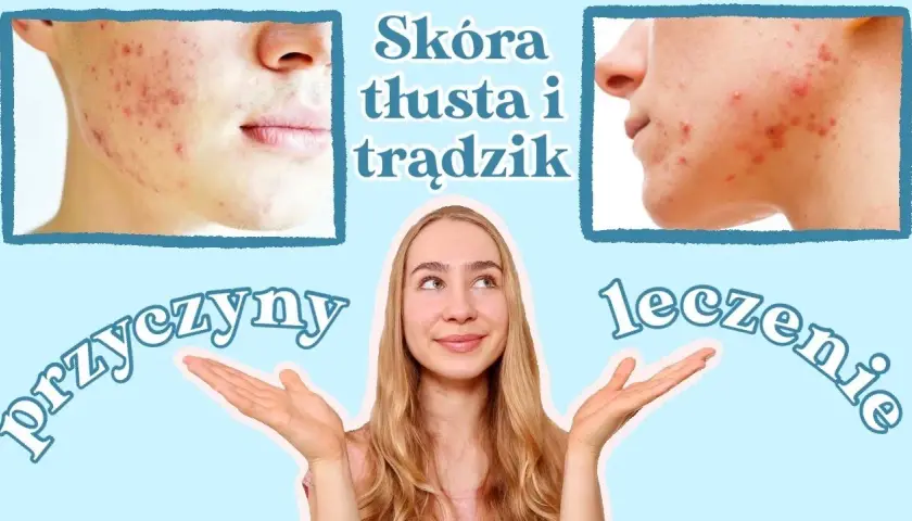 Jak skutecznie pozbyć się tłustej cery – sprawdzone metody i porady
