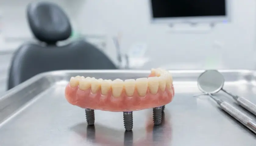 Proteza na implantach, gotowa do montażu. Nowoczesne rozwiązanie dla pełnego uśmiechu.