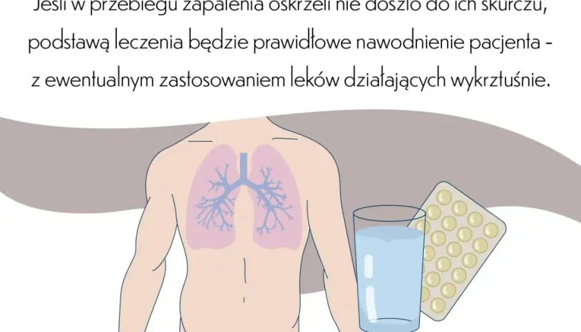 Leczenie zapalenia oskrzeli: Kiedy antybiotyk, a kiedy domowe sposoby?