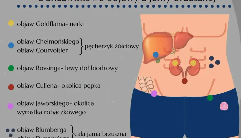 Objaw Chełmońskiego, wskazujący na pęcherzyk żółciowy, zaznaczony niebieską kropką na ilustracji jamy brzusznej.