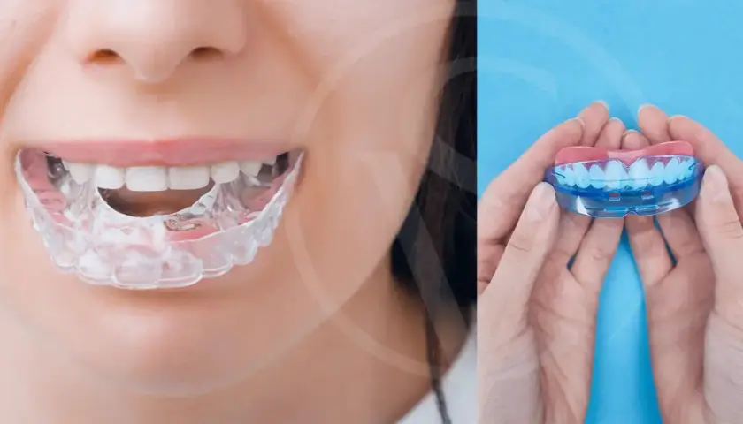 Protector bucal transparente para ayudarte como evitar el bruxismo. En manos, un protector bucal de dos piezas.