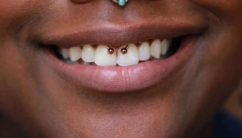 Uśmiechnięte usta z widocznym smiley piercingiem między zębami.